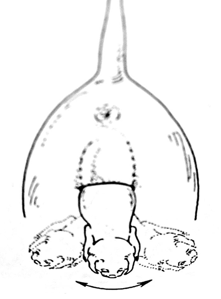 Figura 1 - Manovra ostetriche per disimpegnare le spalle del feto