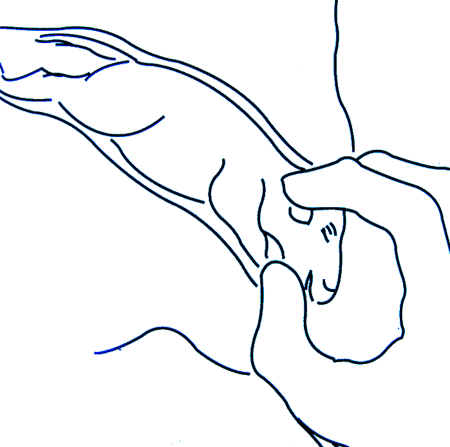 Figura 5 - Manovra ostetrica in caso di presentazione craniale
